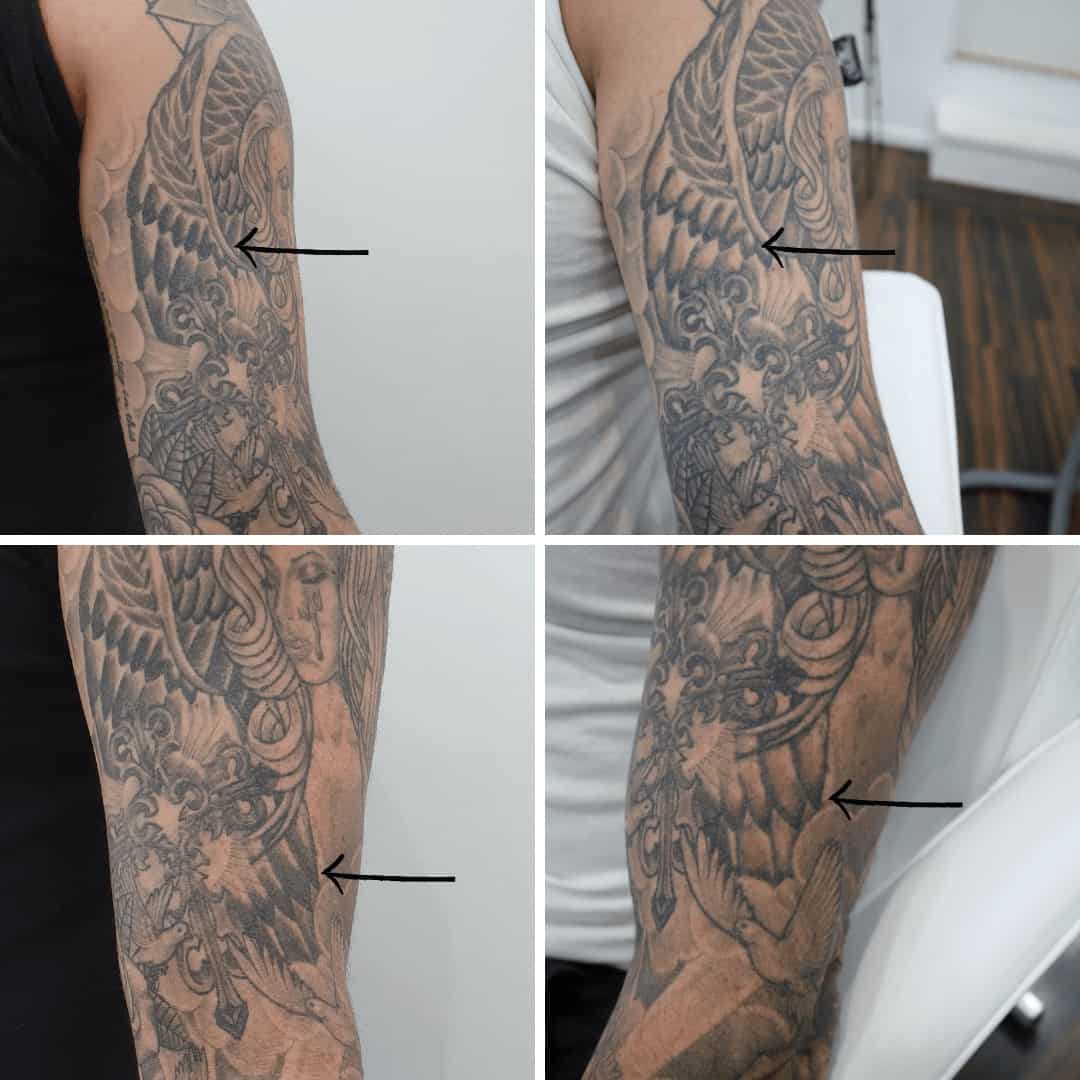 Sleeve tattoo fading