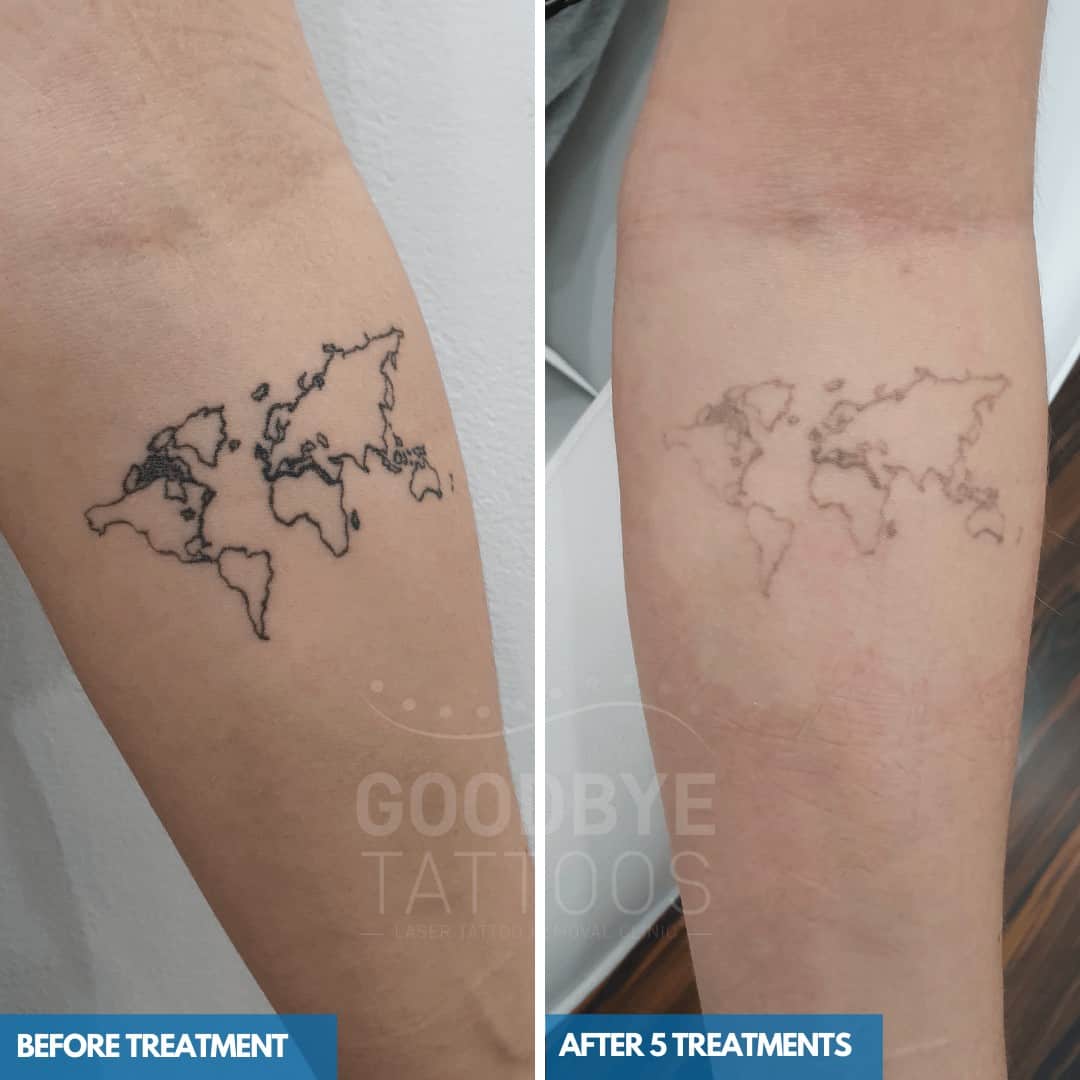 Unwanted atlas tattoo