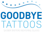 Goodbye Tattoos Neutral Bay