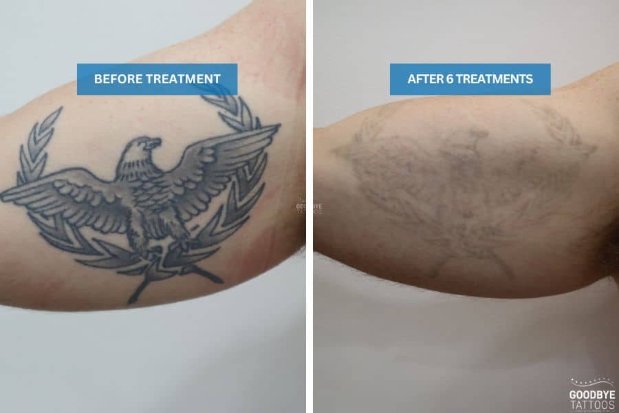 Tattoo fading progress after 6 treatments on arm eagle tattoo